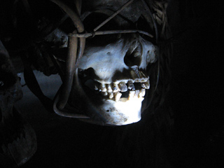 Skull in Pitt Rivers Museum